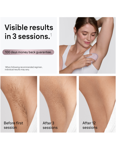 PL1111 Silk-expert IPL mini Fotoepilaator