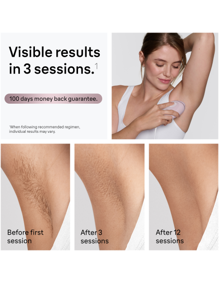 PL1111 Silk-expert IPL mini Fotoepilaator