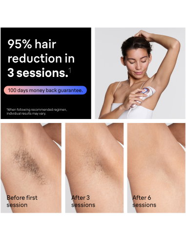 PL7321 Skin i·expert Pro7 IPL Fotoepilaator