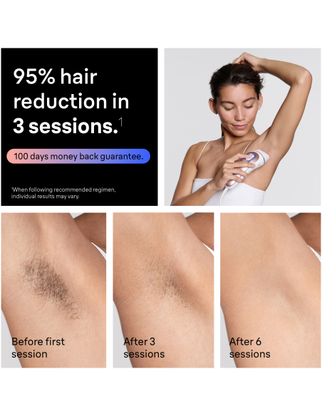 PL7321 Skin i·expert Pro7 IPL Fotoepilaator