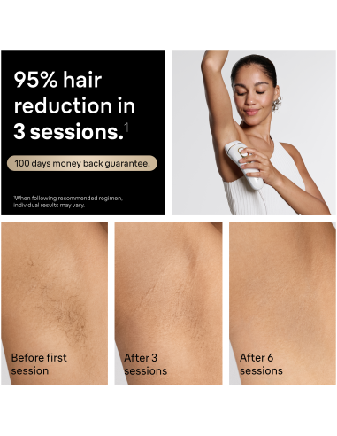 PL5351 Silk-expert Pro 5 IPL Fotoepilaator