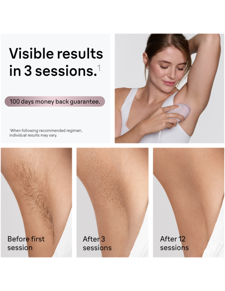 PL1100 Silk-expert IPL mini Fotoepilaator